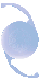 IOL
