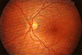 retina normale