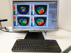 Topografo corneale computerizzato (display)